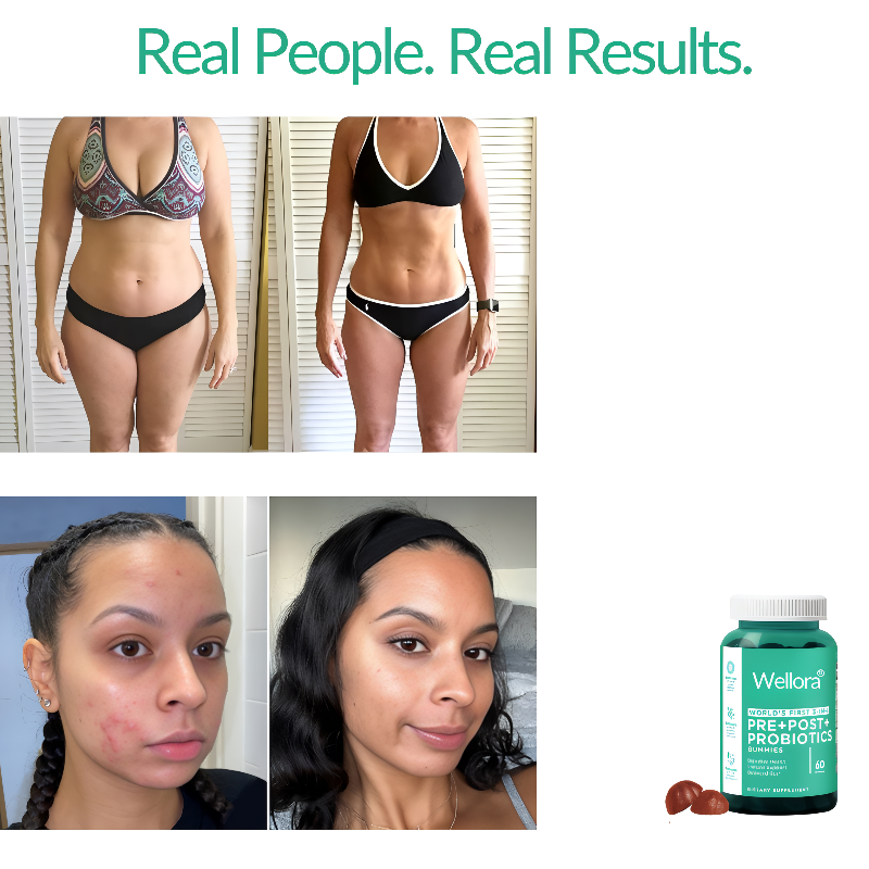 Pre+Pro+Postbiotic Gummies