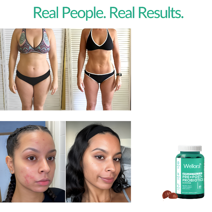Pre+Pro+Postbiotic Gummies